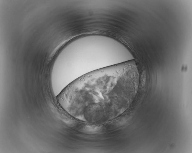 X0000113620351200909181121