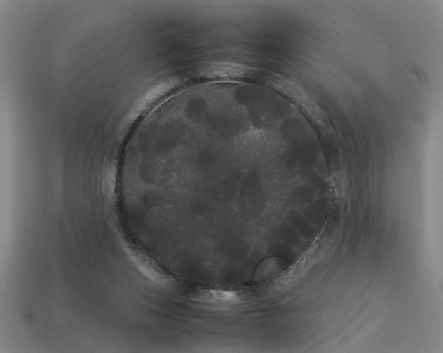 X0000113620159200909181447