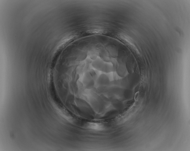 X0000113620167200909181447