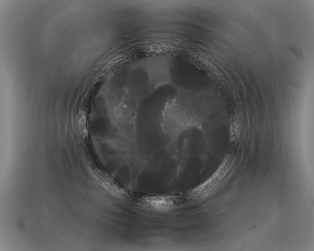 X0000113620187200909181447