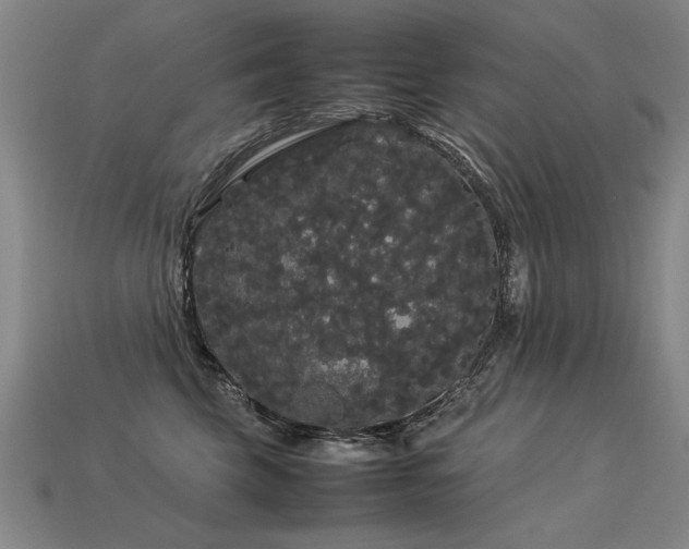 X0000113620569200909181442