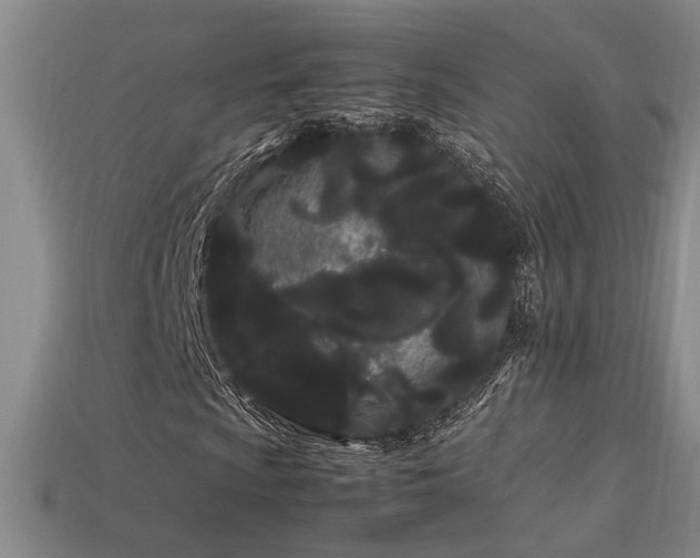 X0000113621009200909181435