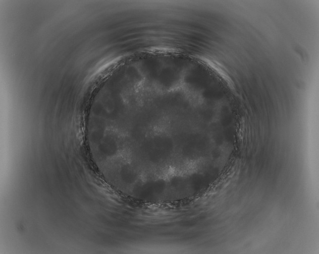 X0000113621015200909181435