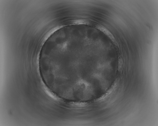 X0000113621039200909181435