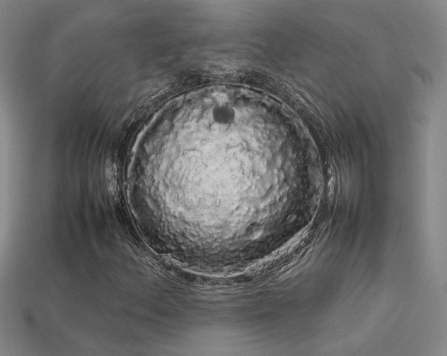 X0000113621156200909181433