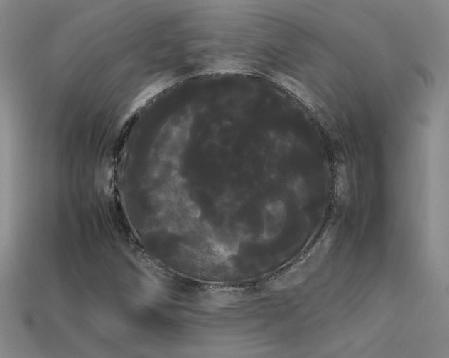 X0000113621258200909181432