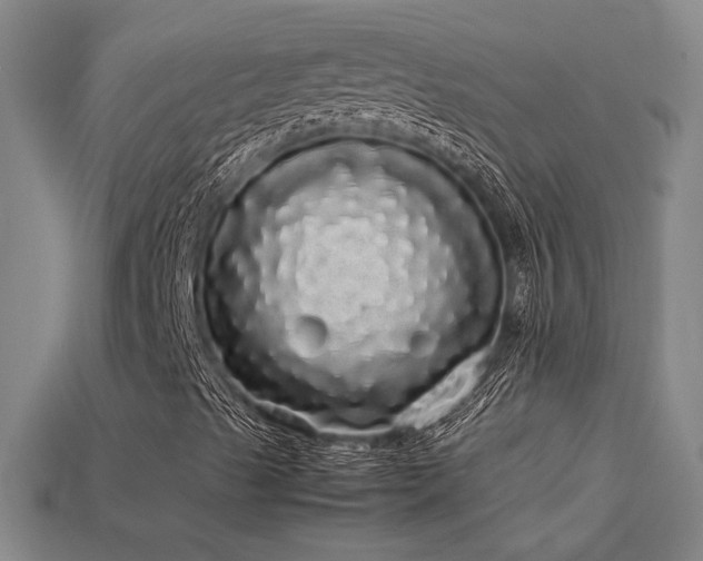 X0000113621489200909181428