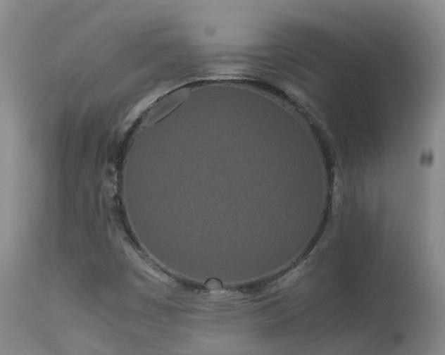 X0000113621449200909251155