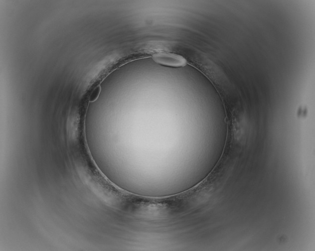 X0000113620304200910021835