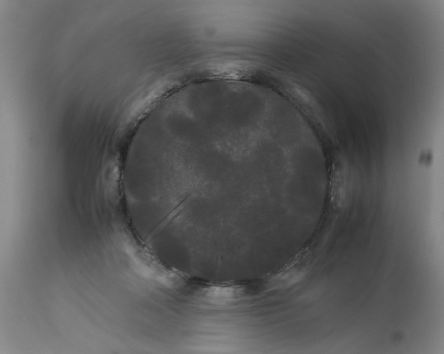 X0000113620314200910021835