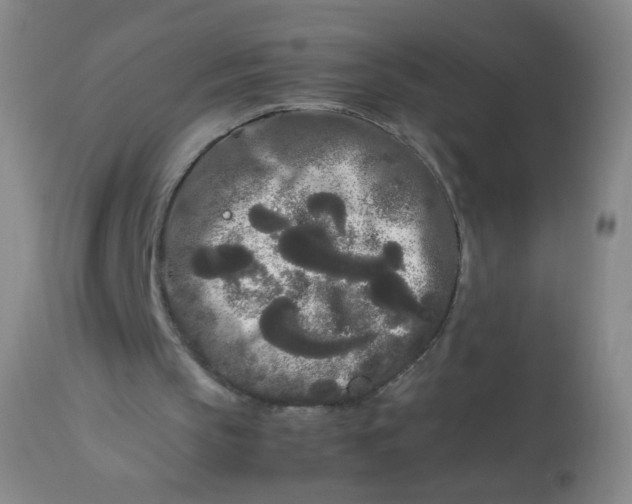 X0000113620145200910091539