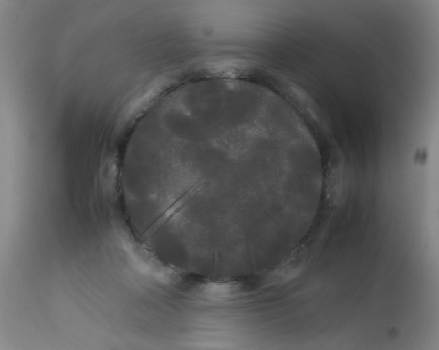 X0000113620314200910091538