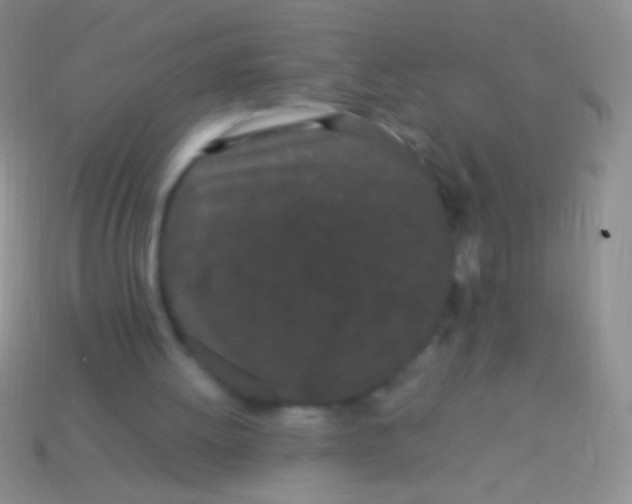 X0000113620052200910162002