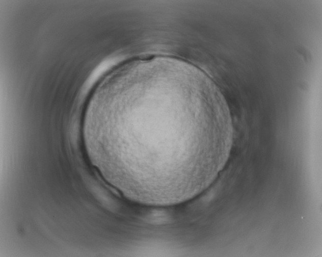 X0000113620056200910162002