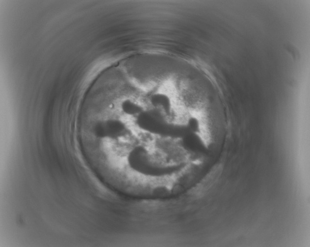 X0000113620145200910162000