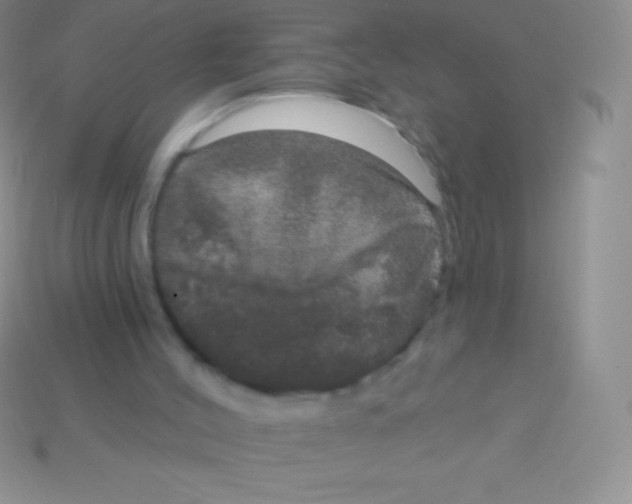 X0000113630004200910162026