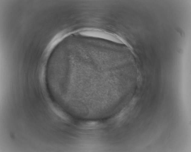 X0000113630151200910162023