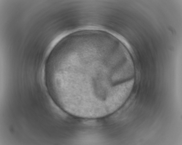 X0000113631006200910162011