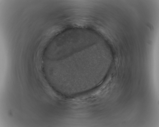 X0000113631009200910162010