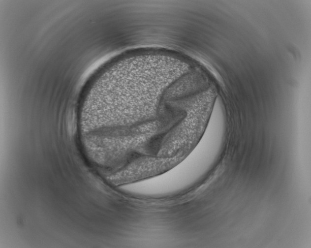 X0000113631069200910162010