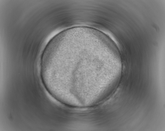 X0000113631143200910162010