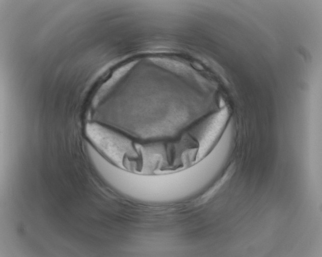 X0000113631449200910162005