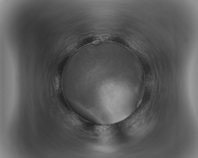 X0000113640139200909181504