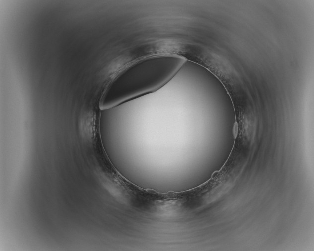 X0000113640356200909181501