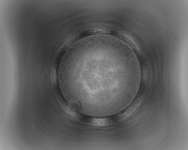 X0000113640457200909181500