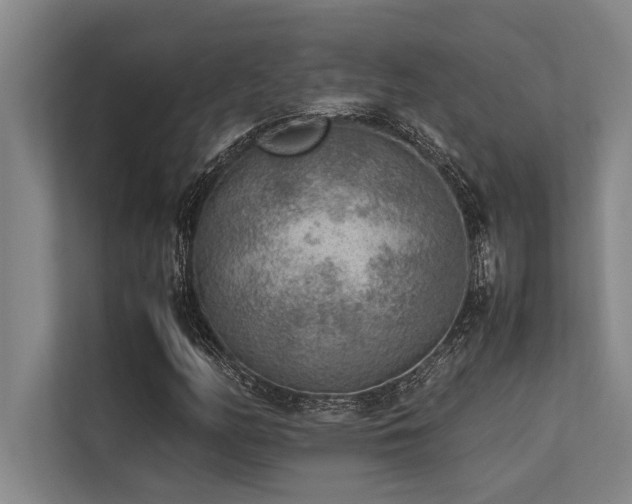 X0000113641158200909181451