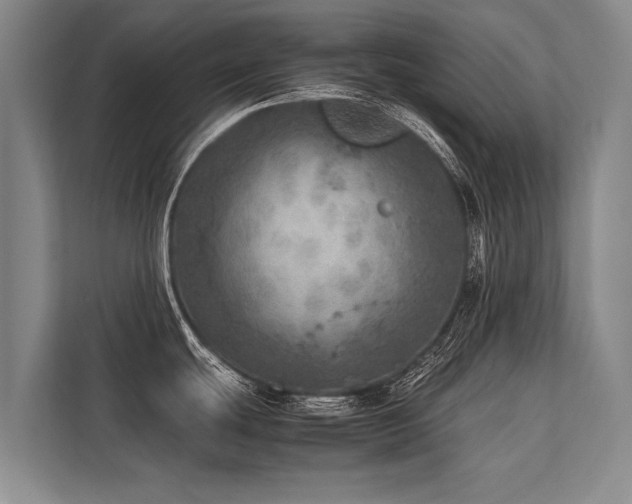 X0000113641439200909181448