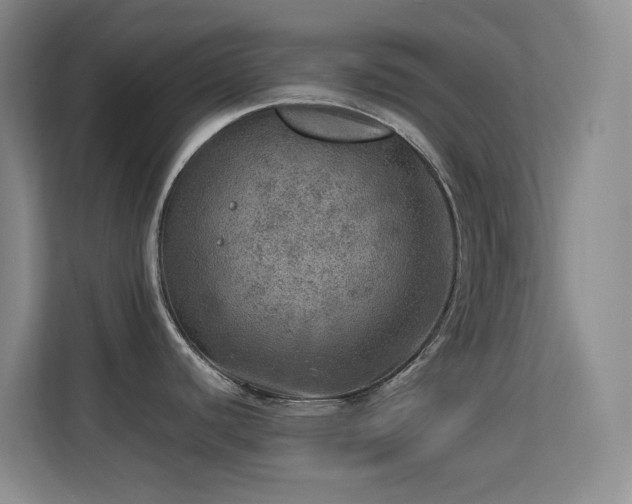 X0000113641440200909251232