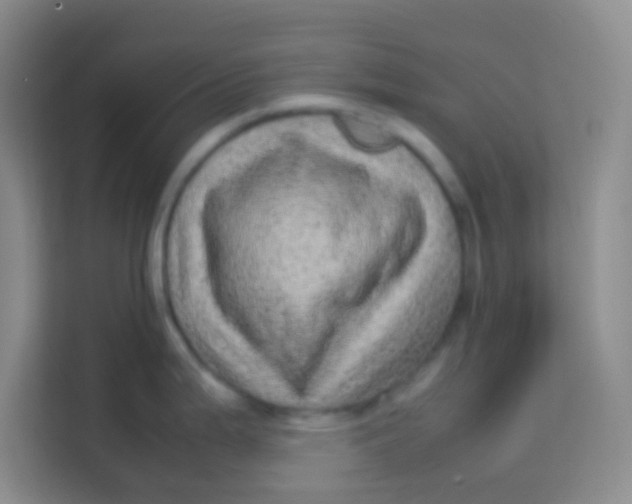 X0000113641199200910091530