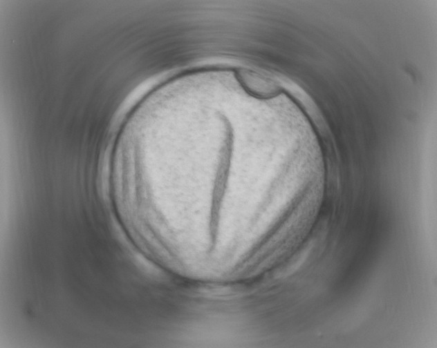 X0000113641199200910162030