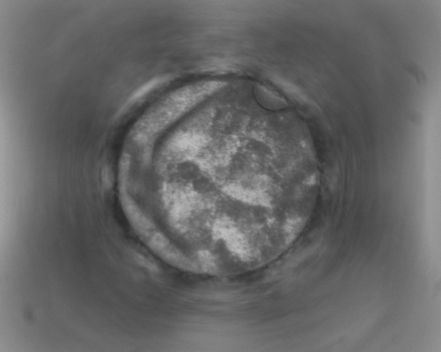 X0000113641206200910162030