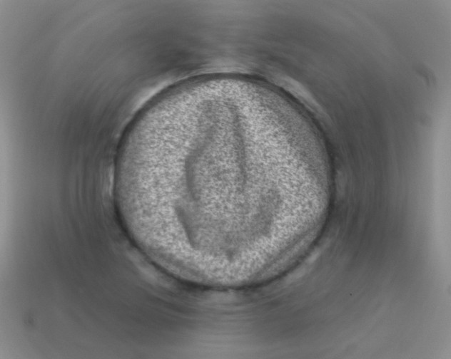 X0000113641220200910162030