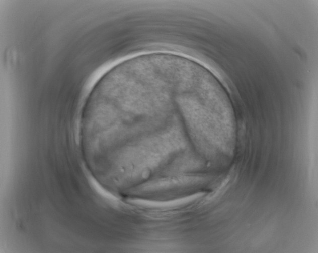 X0000113641535200910162026