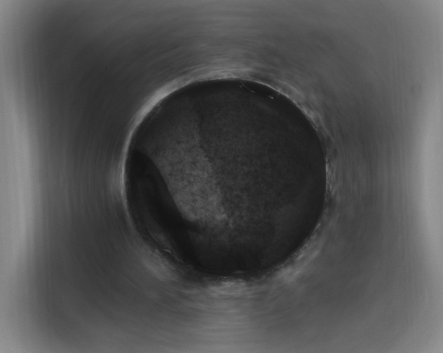 X0000113740196200909301018