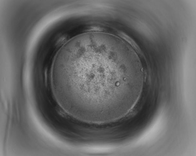 X0000113741439200909301002