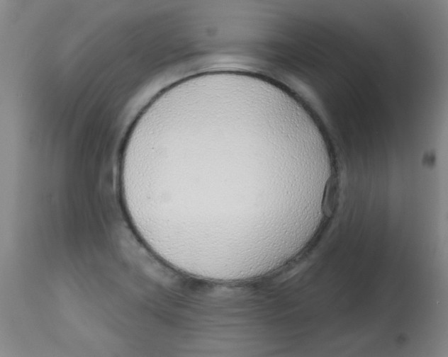 X0000113741419200910211114