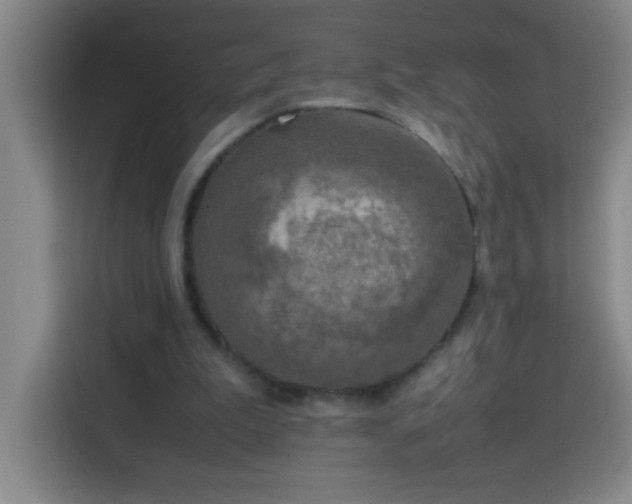 X0000113750199200909301038