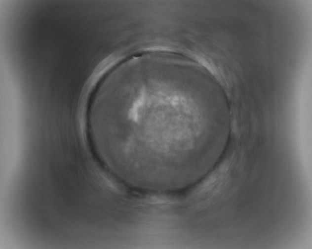 X0000113750199200910071113