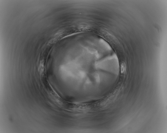 X0000113751011200910141021