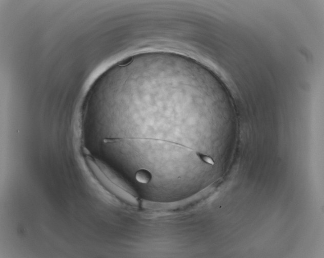 X0000113751522200910141015