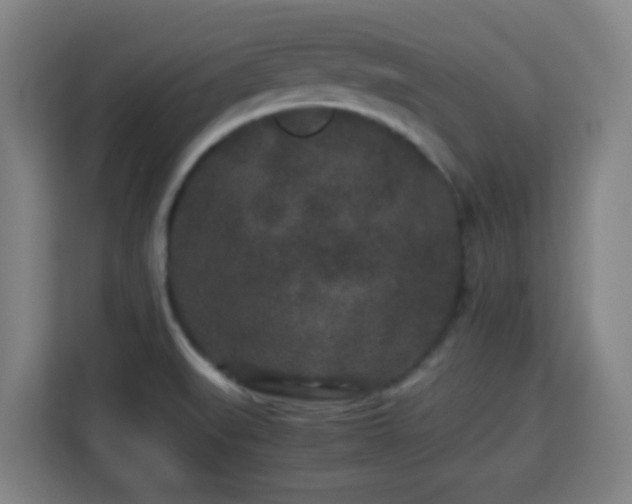 X0000113761519200909301059