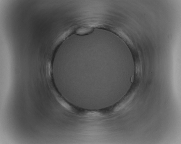 X0000113760397200910071136
