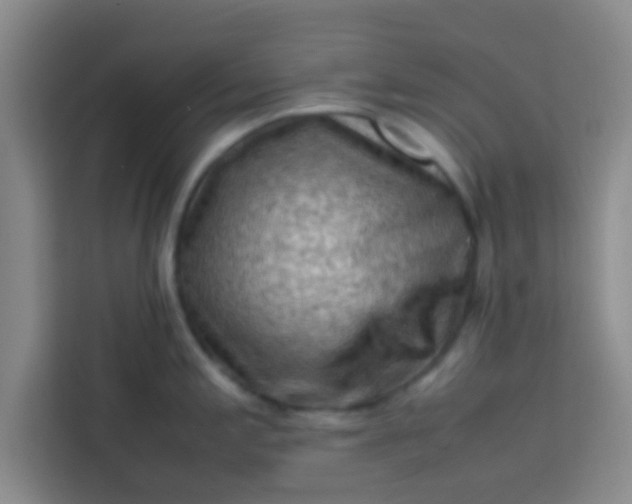 X0000113761197200910071125