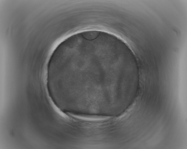 X0000113761519200910141037