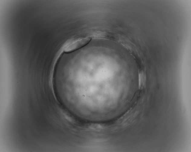 X0000113780195200909301156