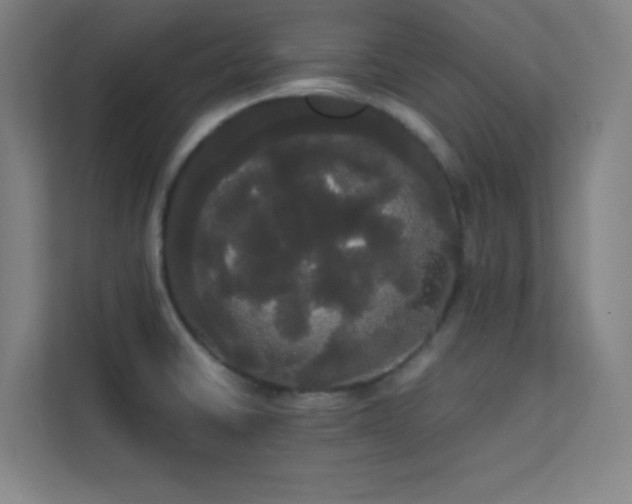 X0000113851430200909241238